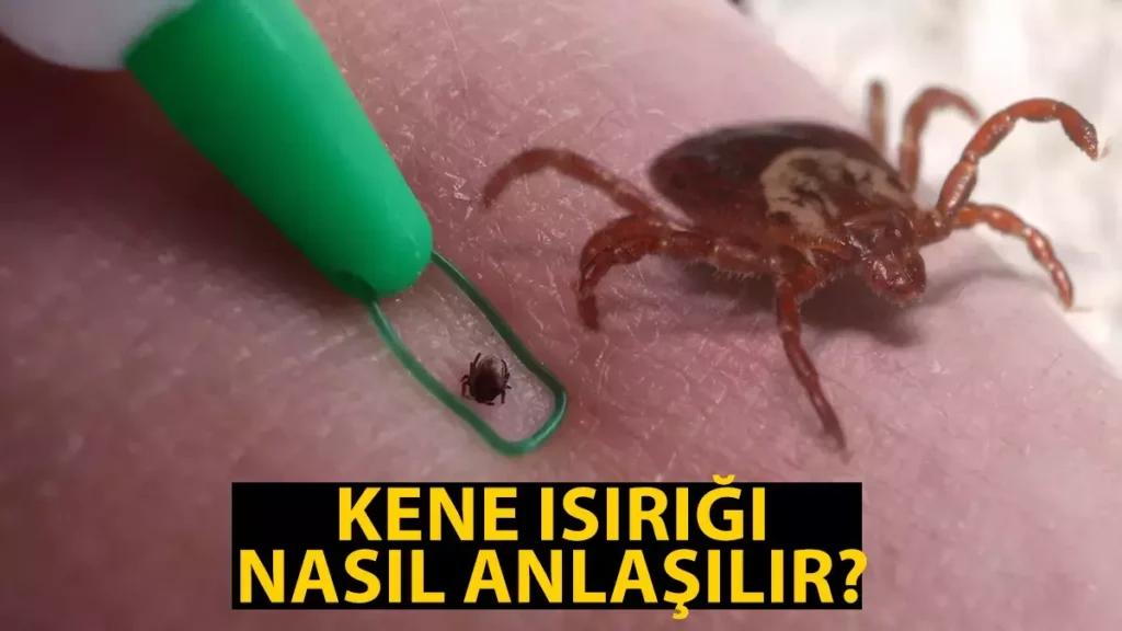 Kene Can Alıyor. Keneye karşı alınacak önlemler neler…